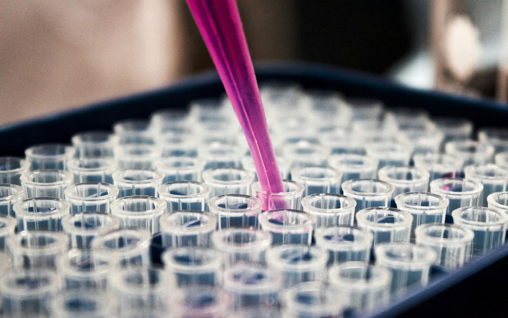 Techniki i wskazówki dotyczące pipetowania